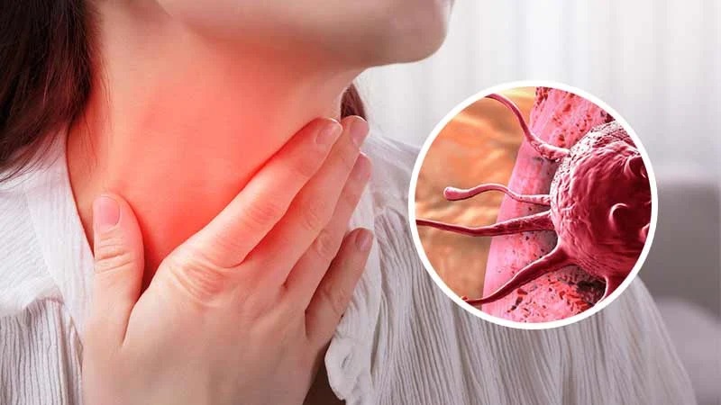 Lenfoma, bağışıklık sistemimizin temel yapı taşlarından biri olan lenfatik sistemde