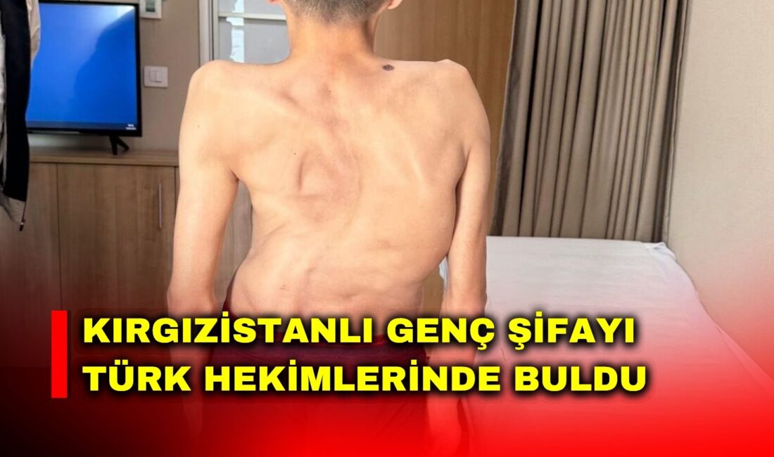Kırgızistan’da 18 yaşına kadar skolyozla mücadele eden genç, Medicana Hastanesi’nde