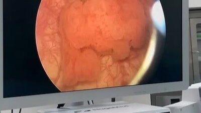 Bayburt Devlet Hastanesi üroloji kliniğinde farklı rahatsızlıkları bulunan 6 hasta,