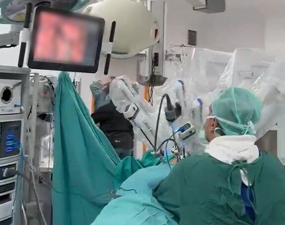 Karadeniz’de ilk: Robot yardımlı akciğer kanseri ameliyatı gerçekleştirildi SAMSUN (İHA) – Ondokuz Mayıs Üniversitesi (OMÜ) Tıp Fakültesi Hastanesi’nde