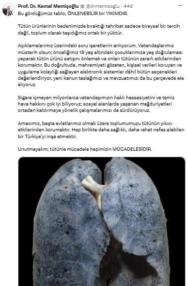 Sağlık Bakanı Kemal Memişoğlu, “Tütün ürünlerinin bedenimizde bıraktığı tahribat sadece