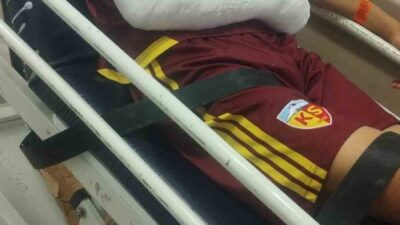 Kayserispor U19 takımının başarılı oyuncusu Hilmi Türkan’ın Hatayspor maçında kolu
