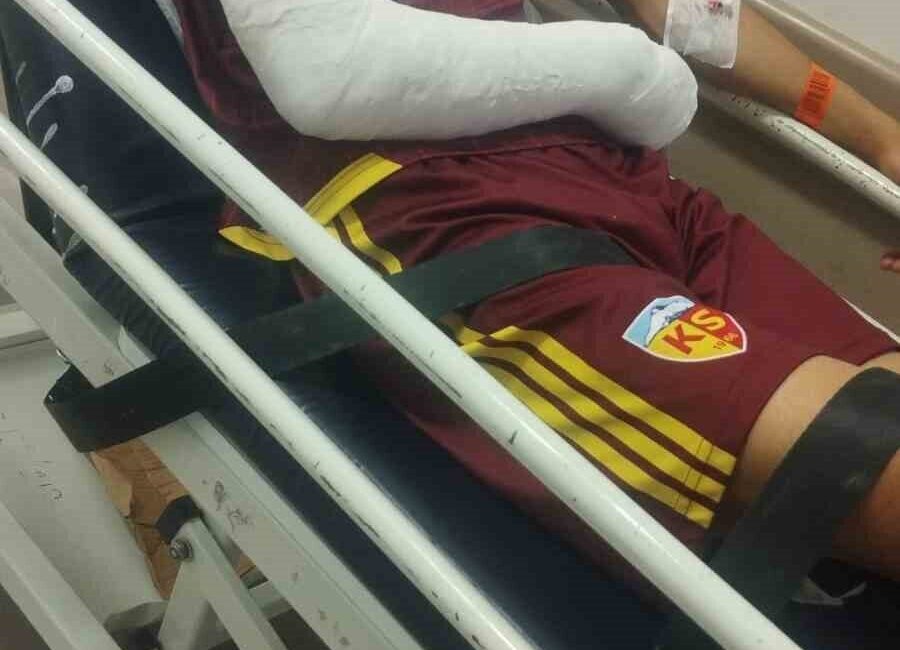 Kayserispor U19 takımının başarılı oyuncusu Hilmi Türkan’ın Hatayspor maçında kolu