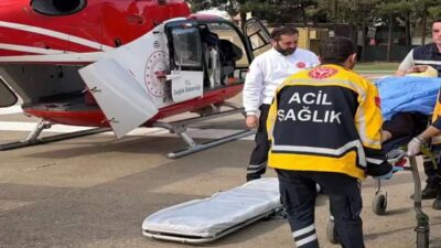 Şırnak’ta sağlık durumu kritik olan 56 yaşındaki yanık hastası ile